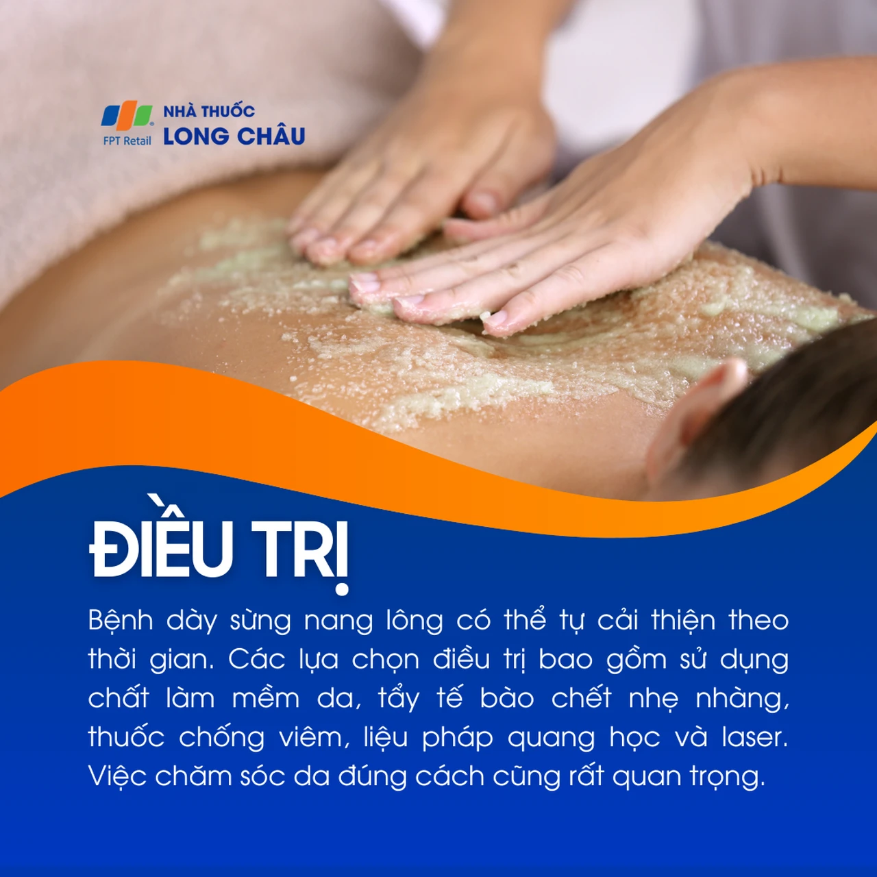 Hình ảnh minh họa