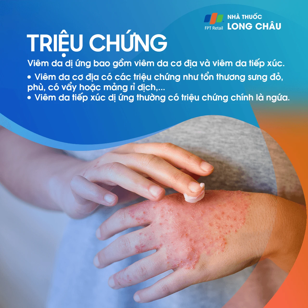 Hình ảnh minh họa