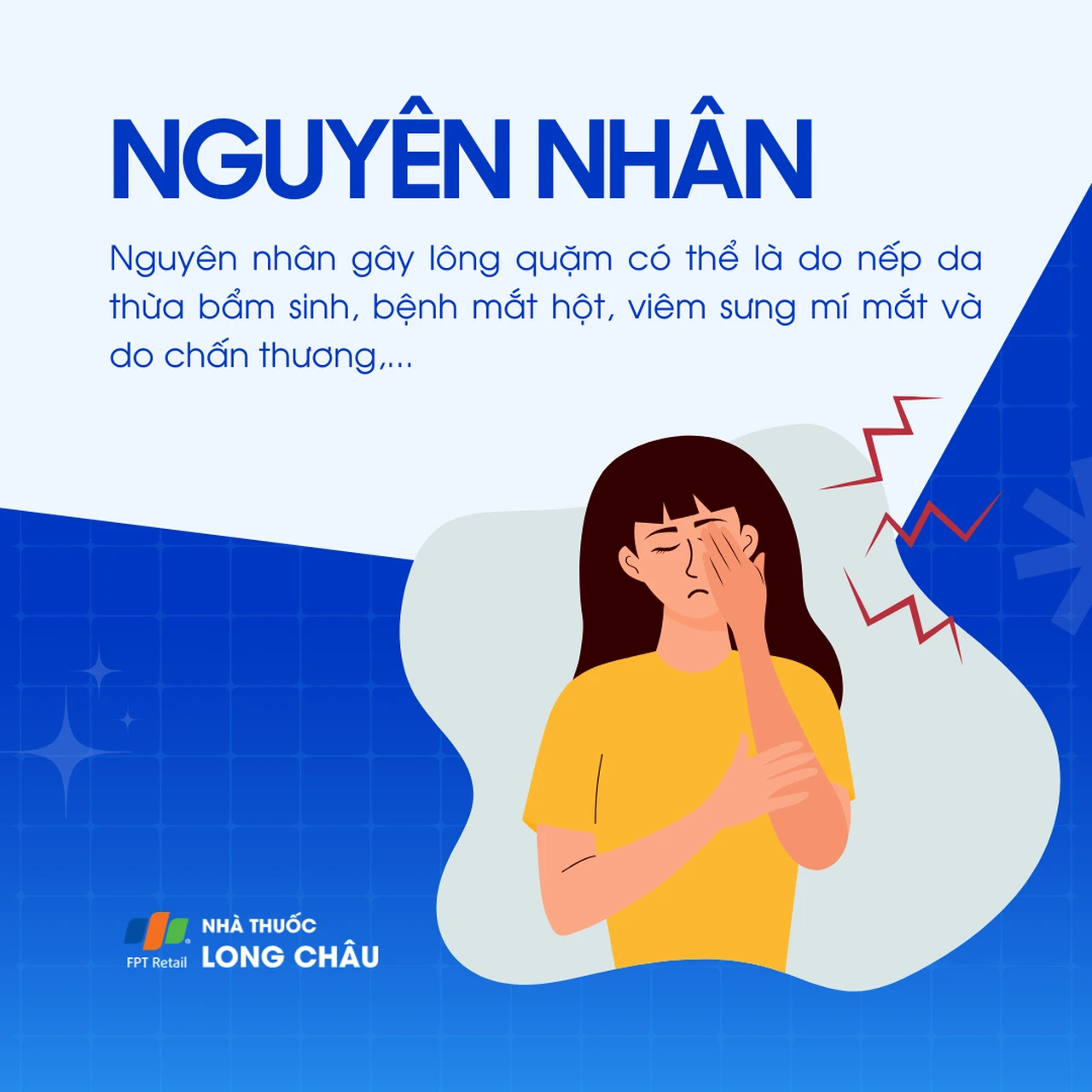 Hình ảnh minh họa