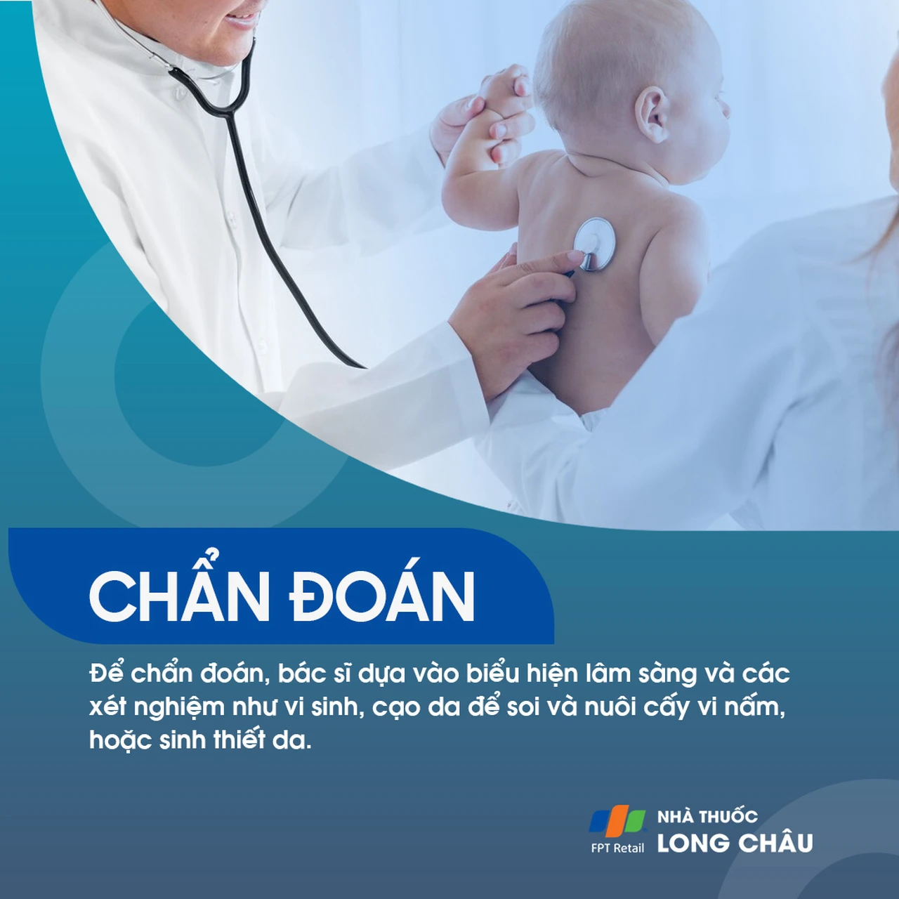 Hình ảnh minh họa