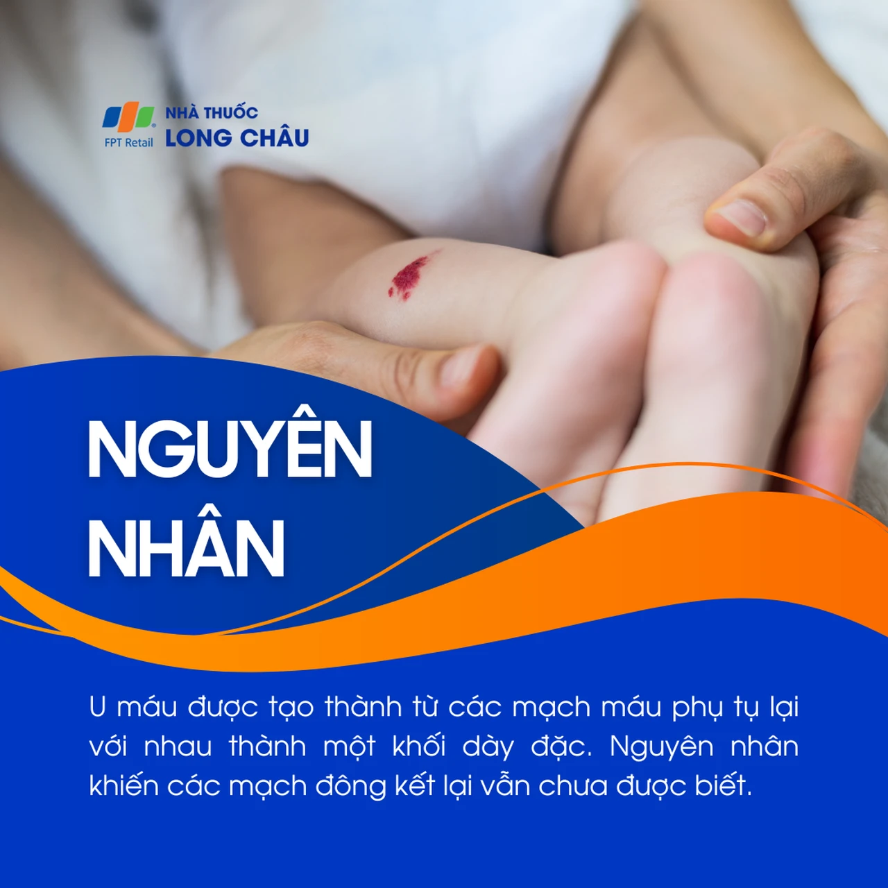 Hình ảnh minh họa