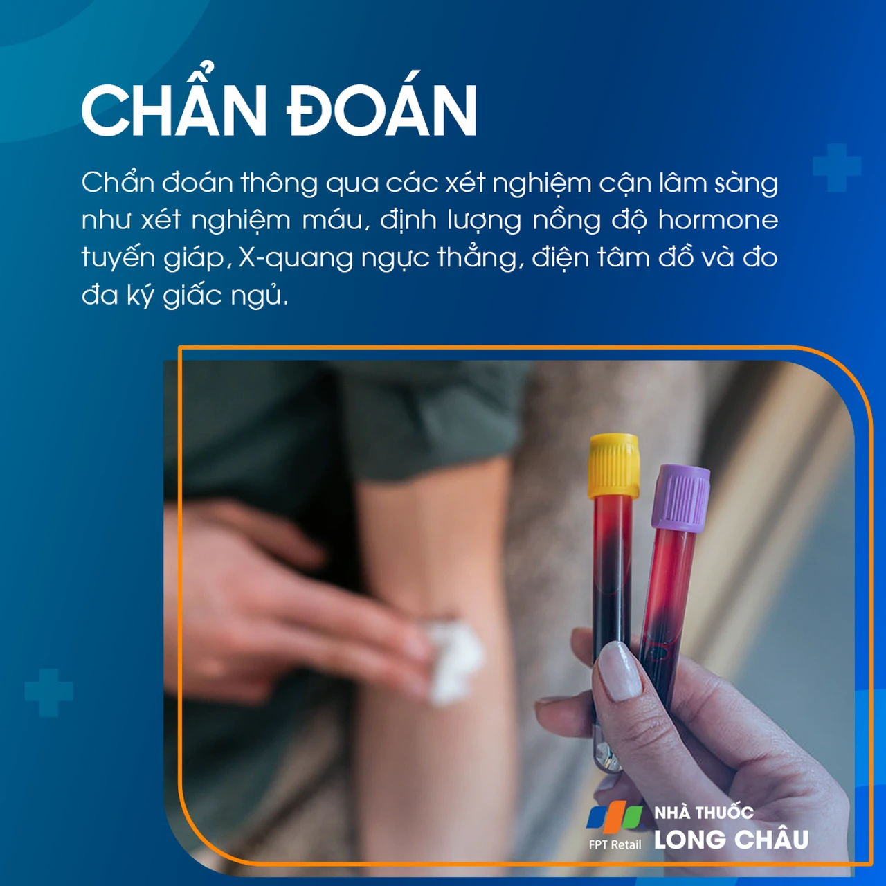 Hình ảnh minh họa