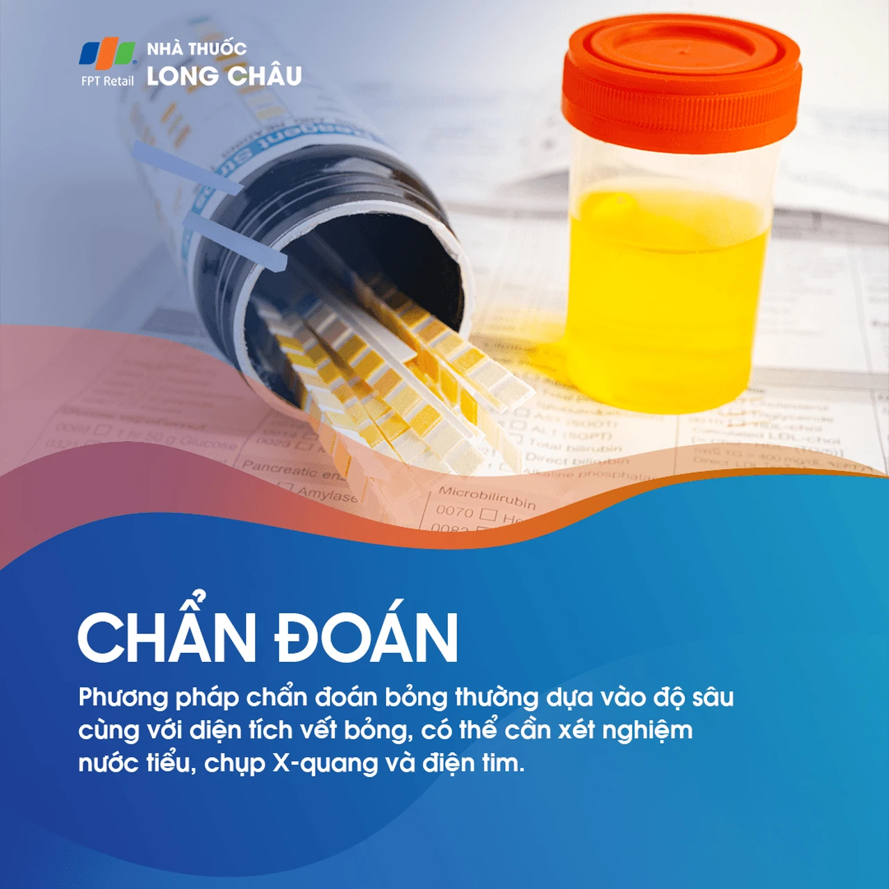 Hình ảnh minh họa