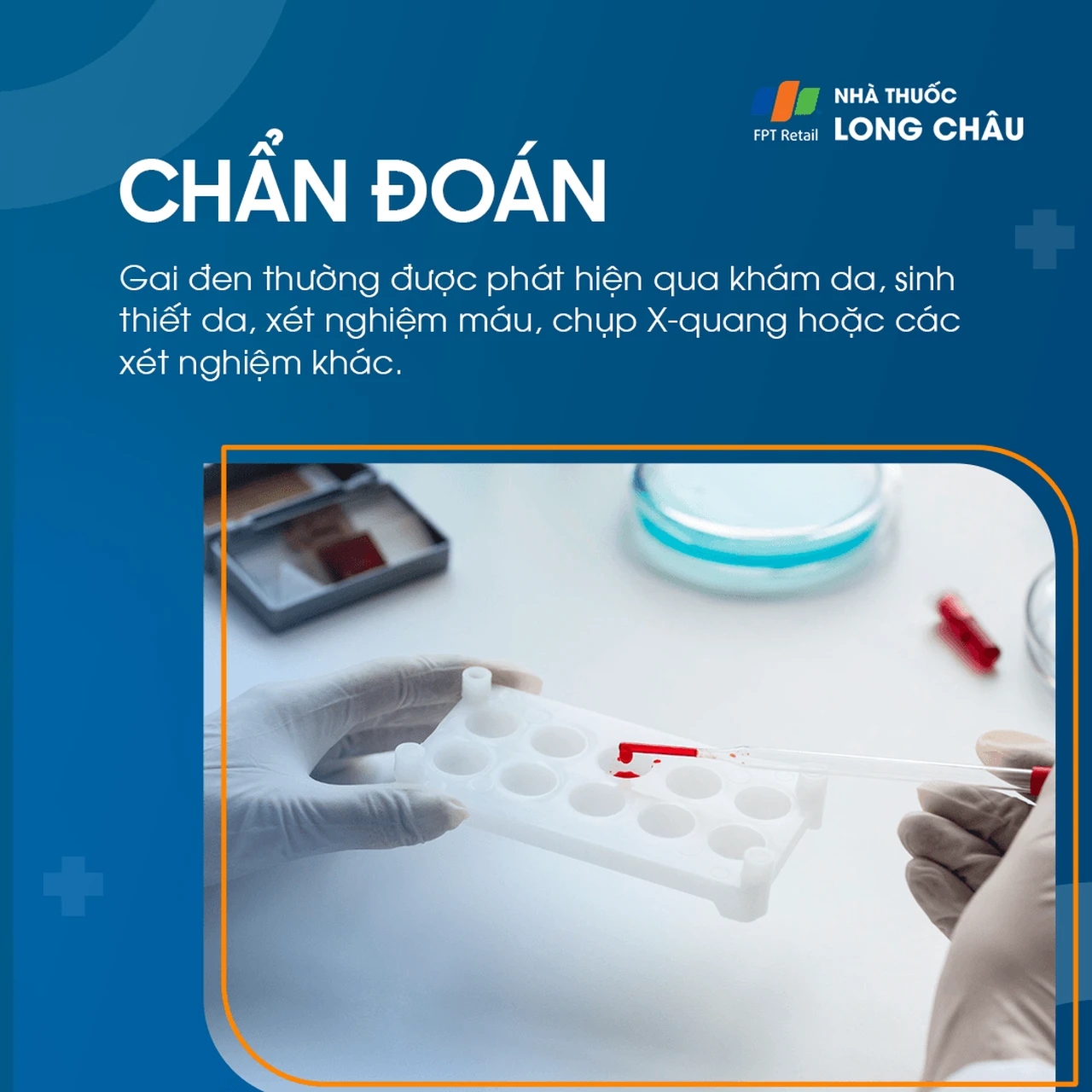 Hình ảnh minh họa