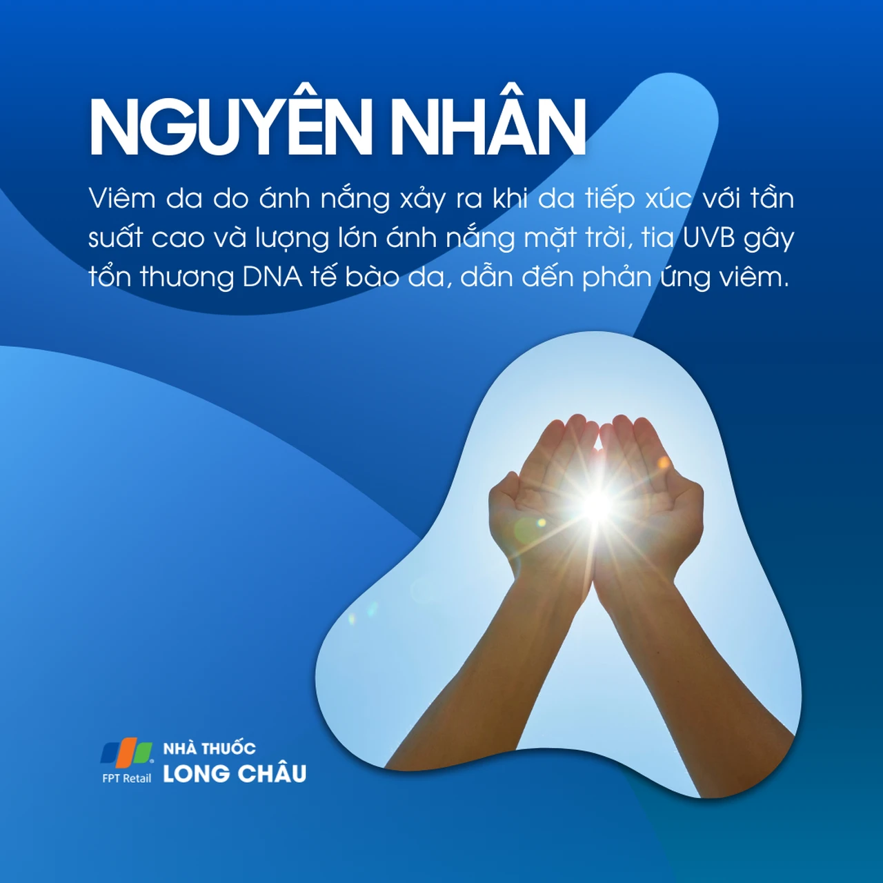 Hình ảnh minh họa