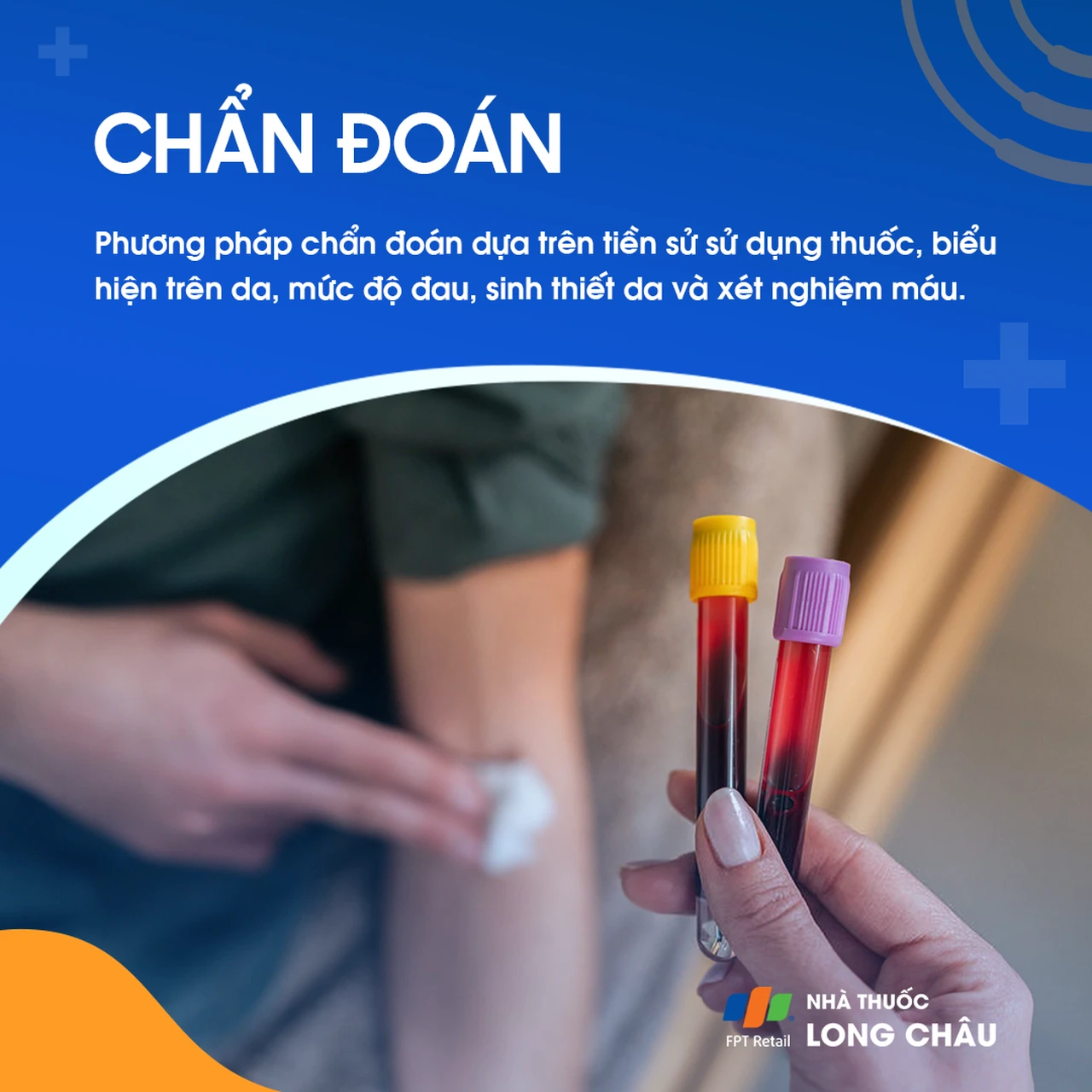 Hình ảnh minh họa
