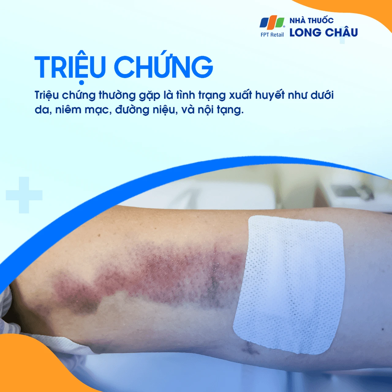 Hình ảnh minh họa