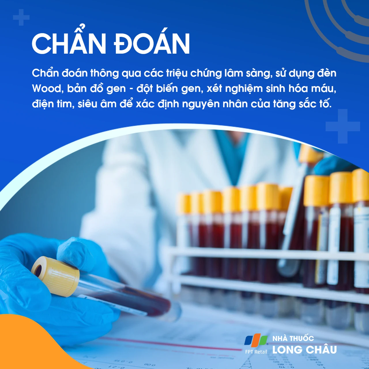 Hình ảnh minh họa