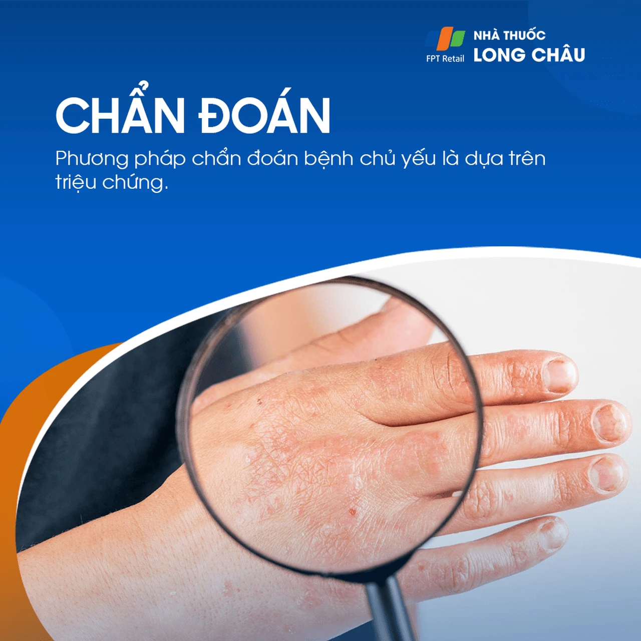 Hình ảnh minh họa