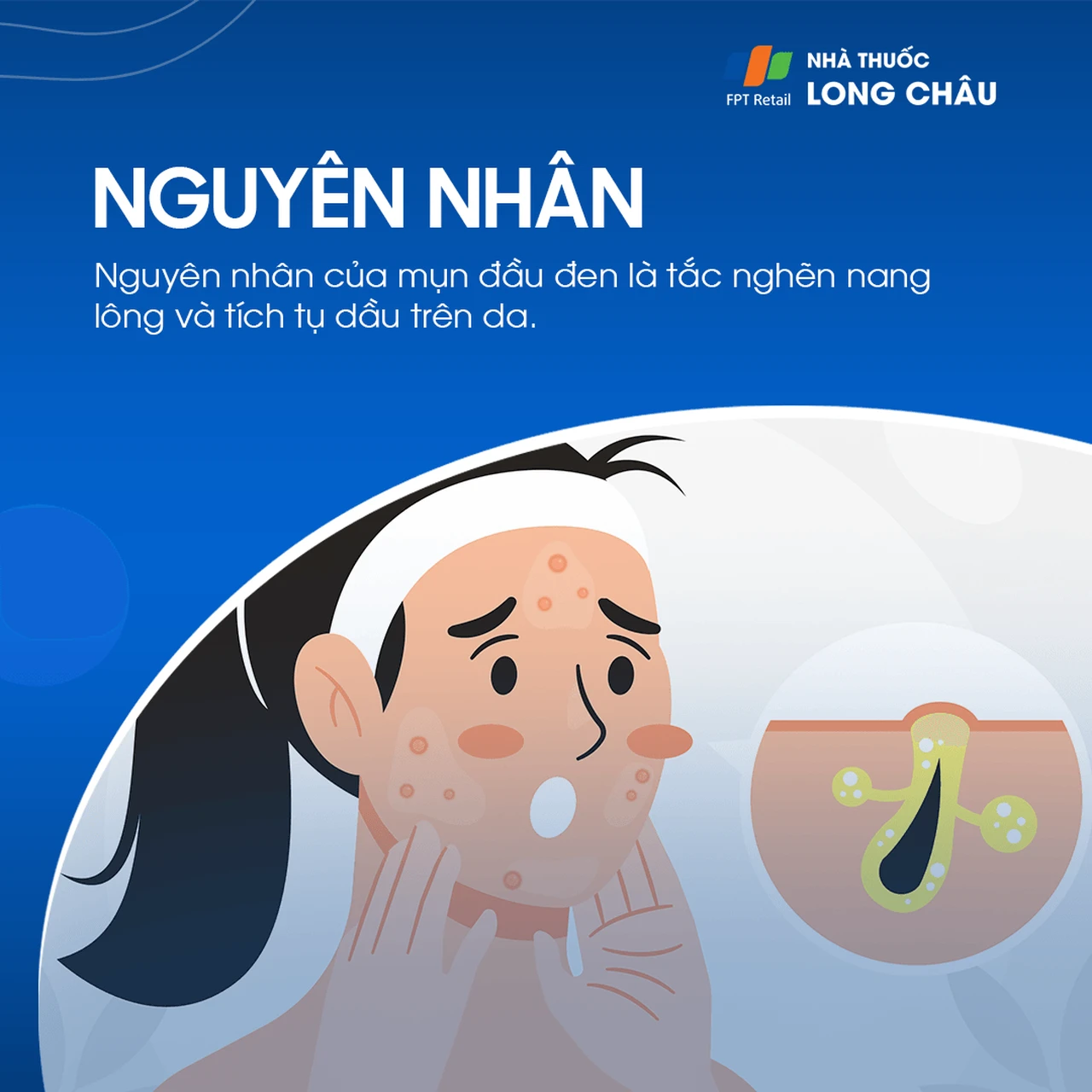 Hình ảnh minh họa