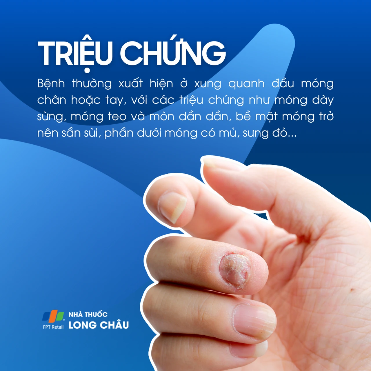 Hình ảnh minh họa