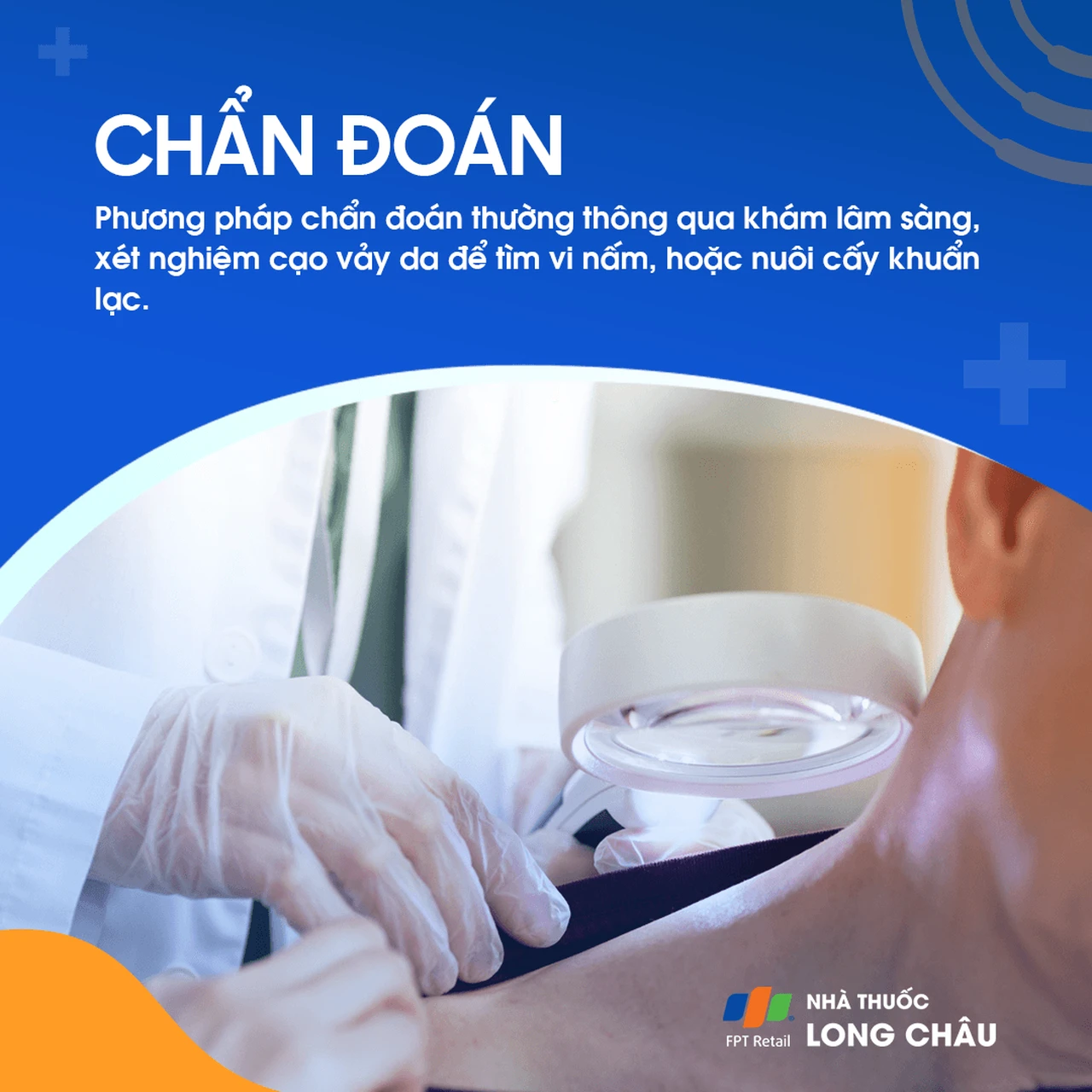 Hình ảnh minh họa