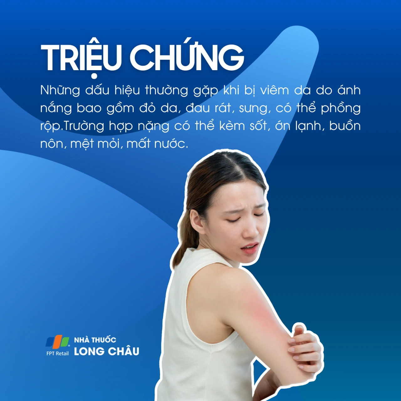 Hình ảnh minh họa