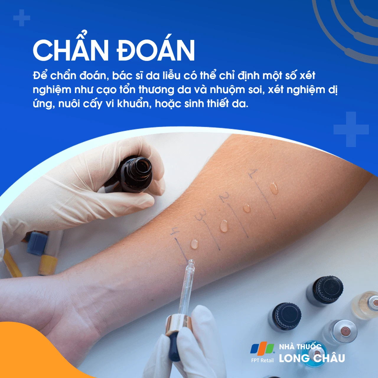 Hình ảnh minh họa