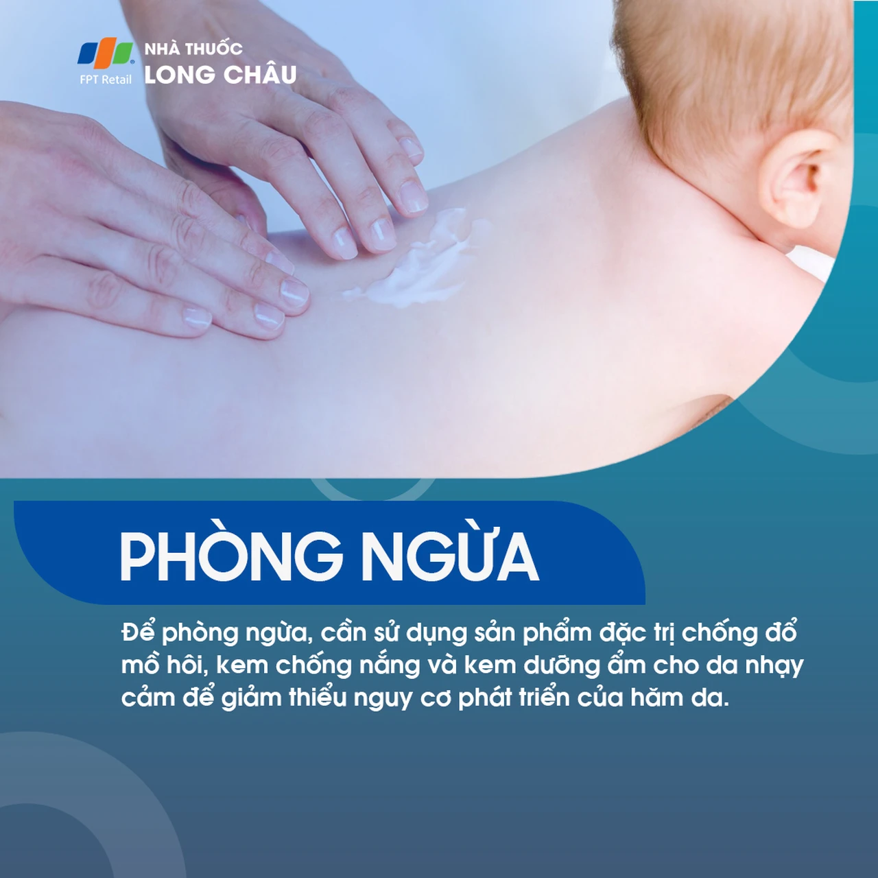 Hình ảnh minh họa