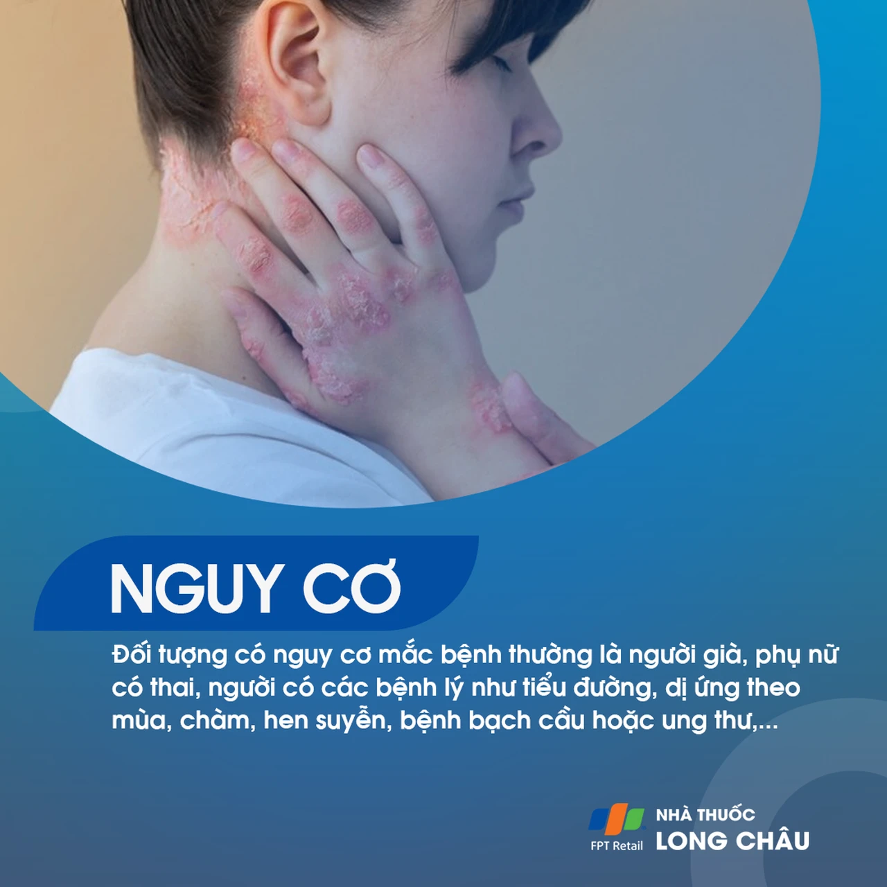 Hình ảnh minh họa