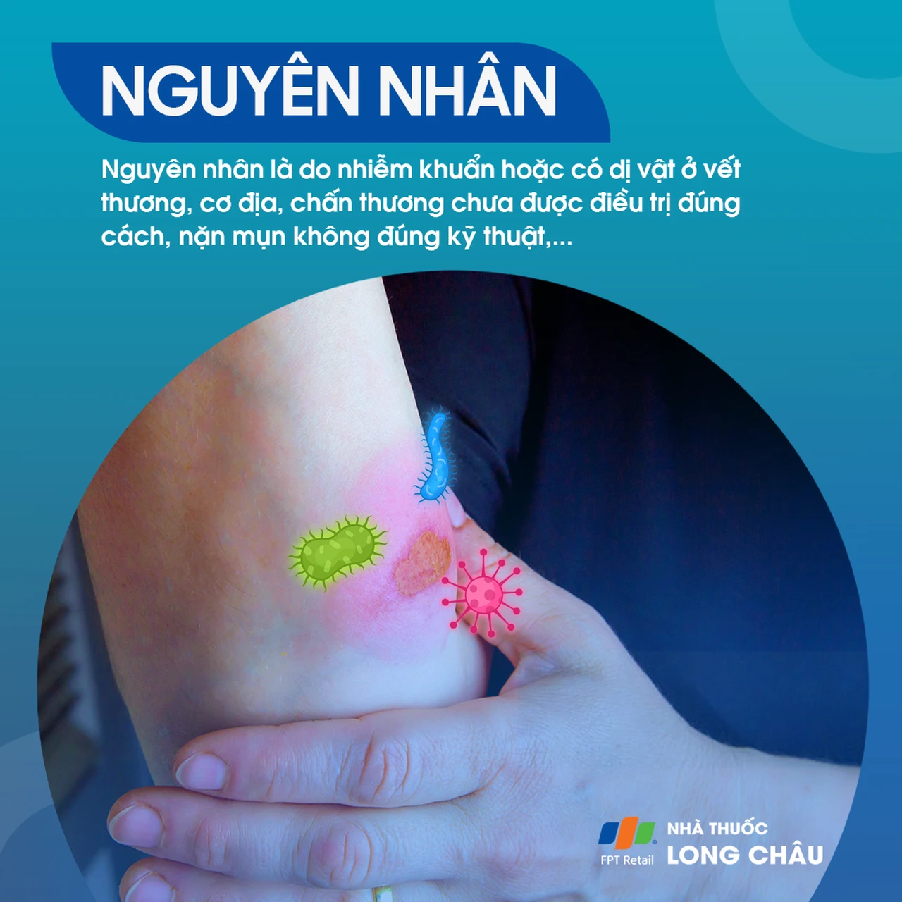 Hình ảnh minh họa