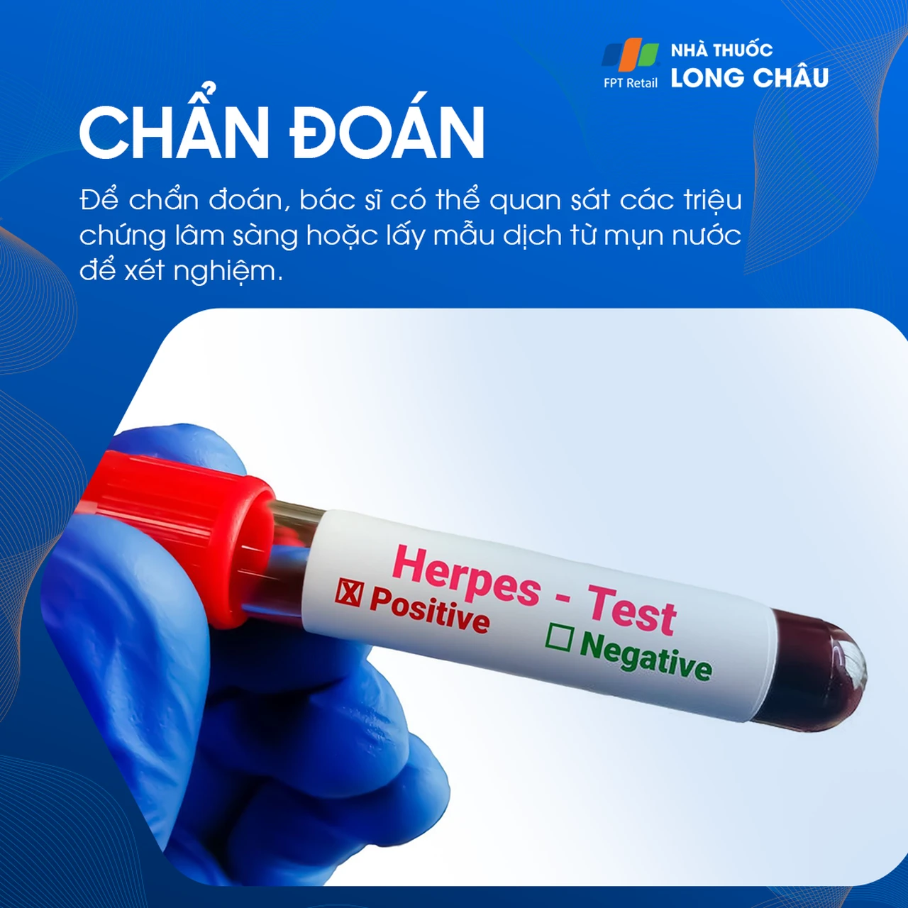 Hình ảnh minh họa