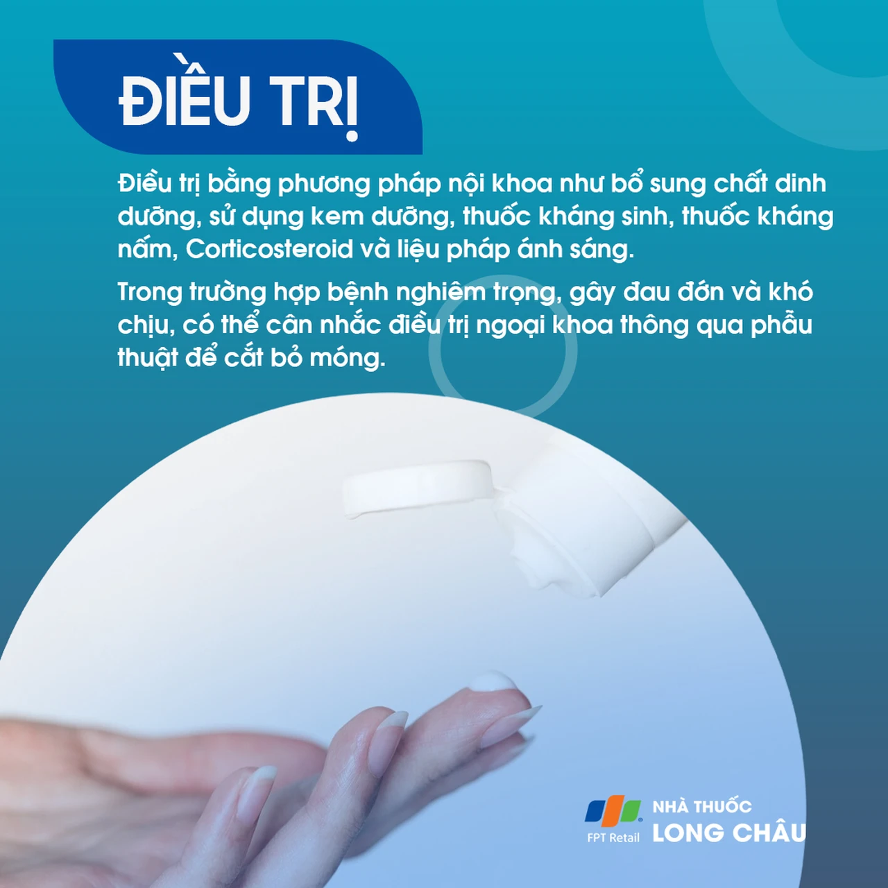 Hình ảnh minh họa