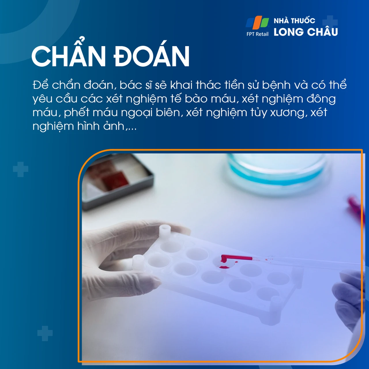 Hình ảnh minh họa