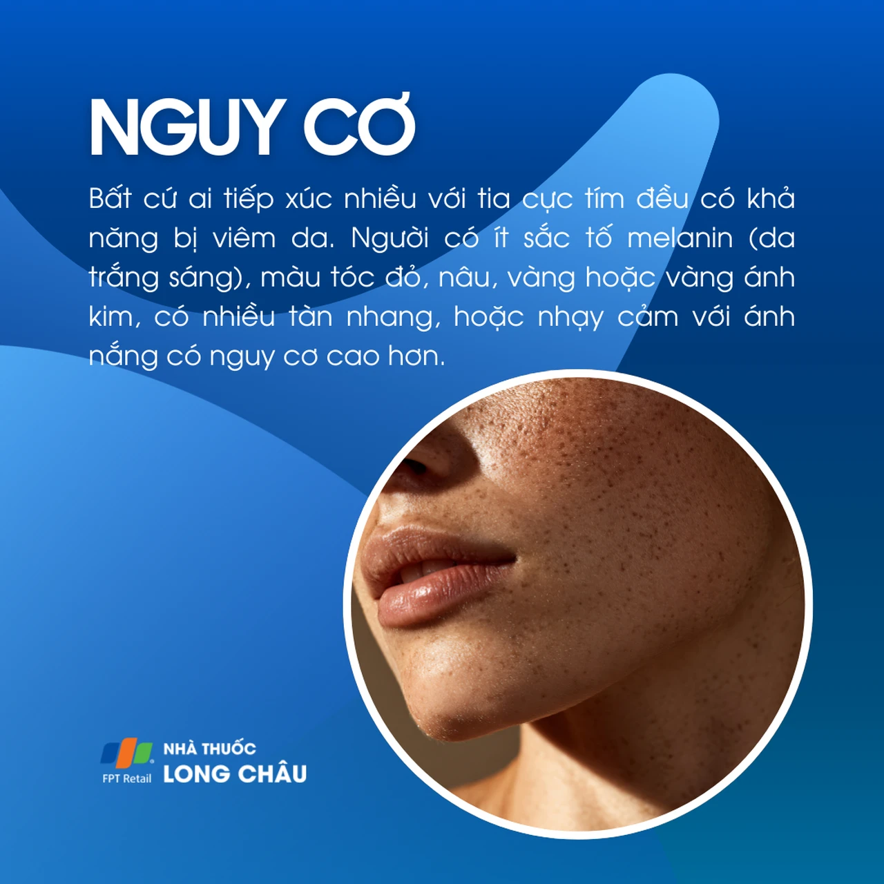 Hình ảnh minh họa