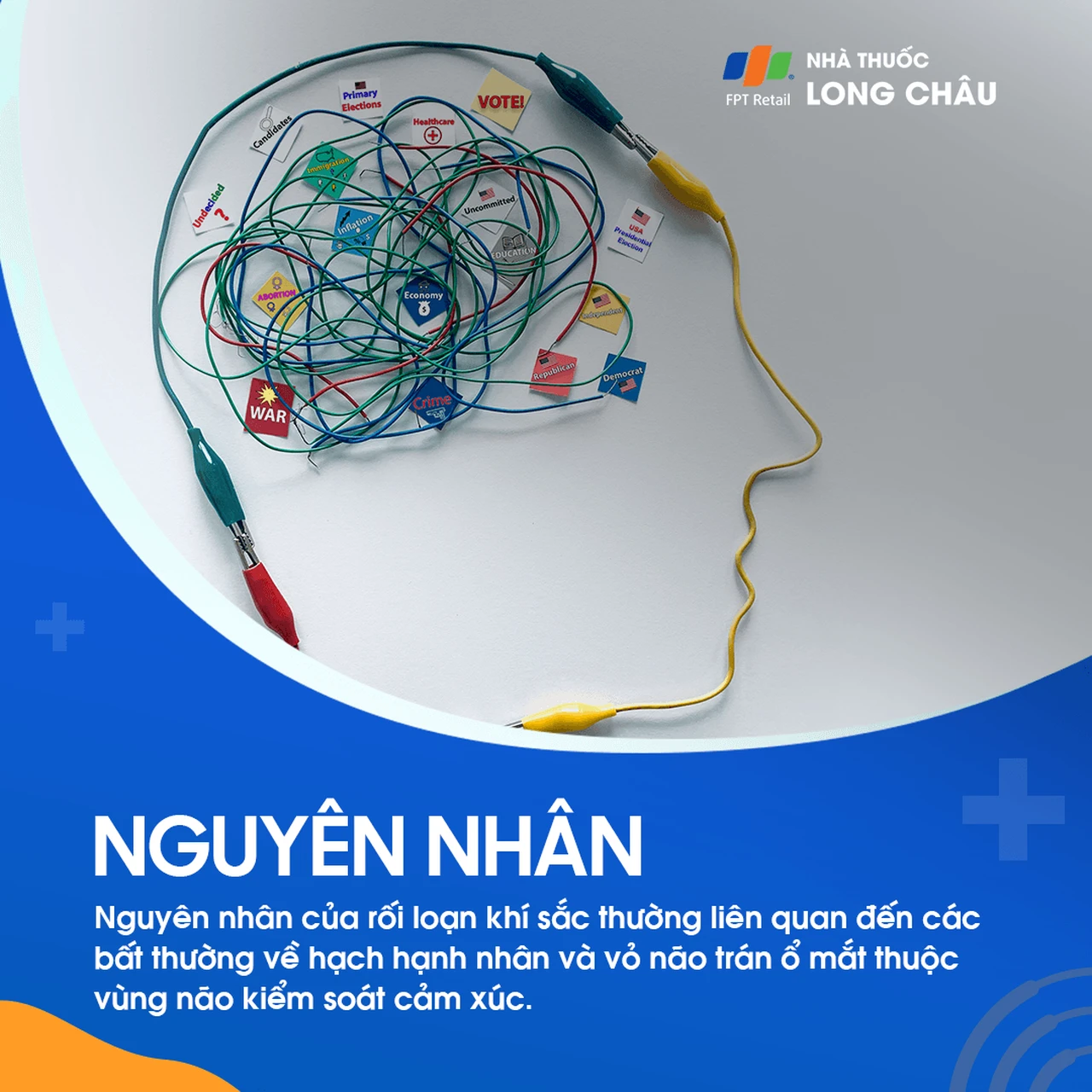 Hình ảnh minh họa