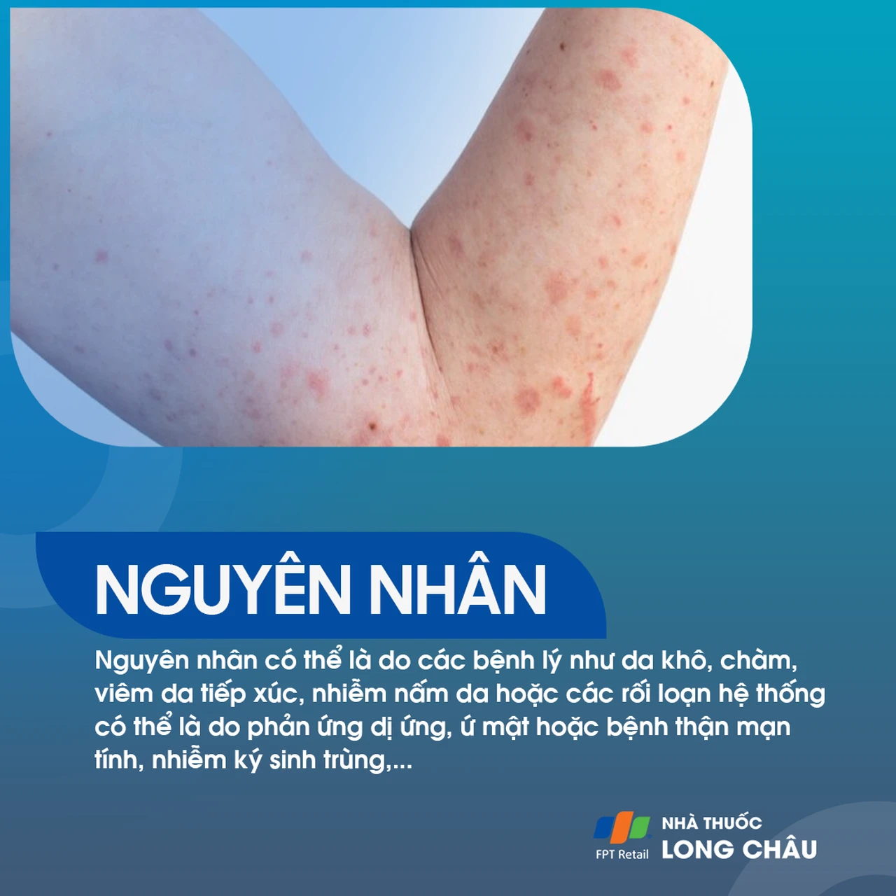 Hình ảnh minh họa