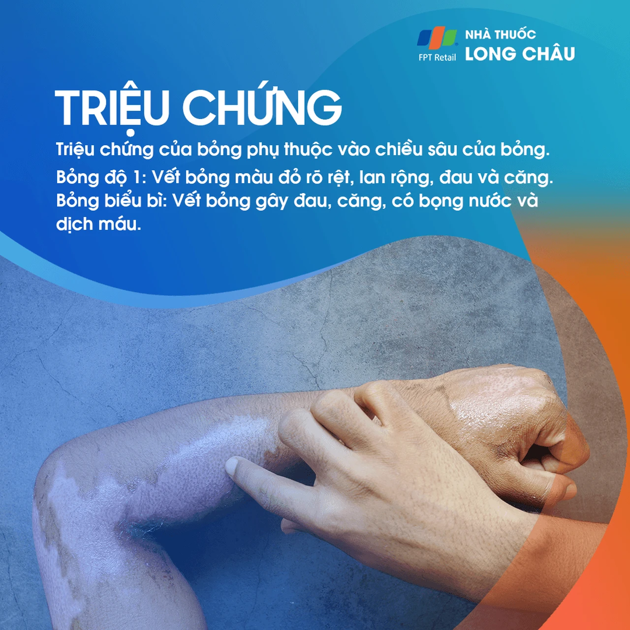 Hình ảnh minh họa