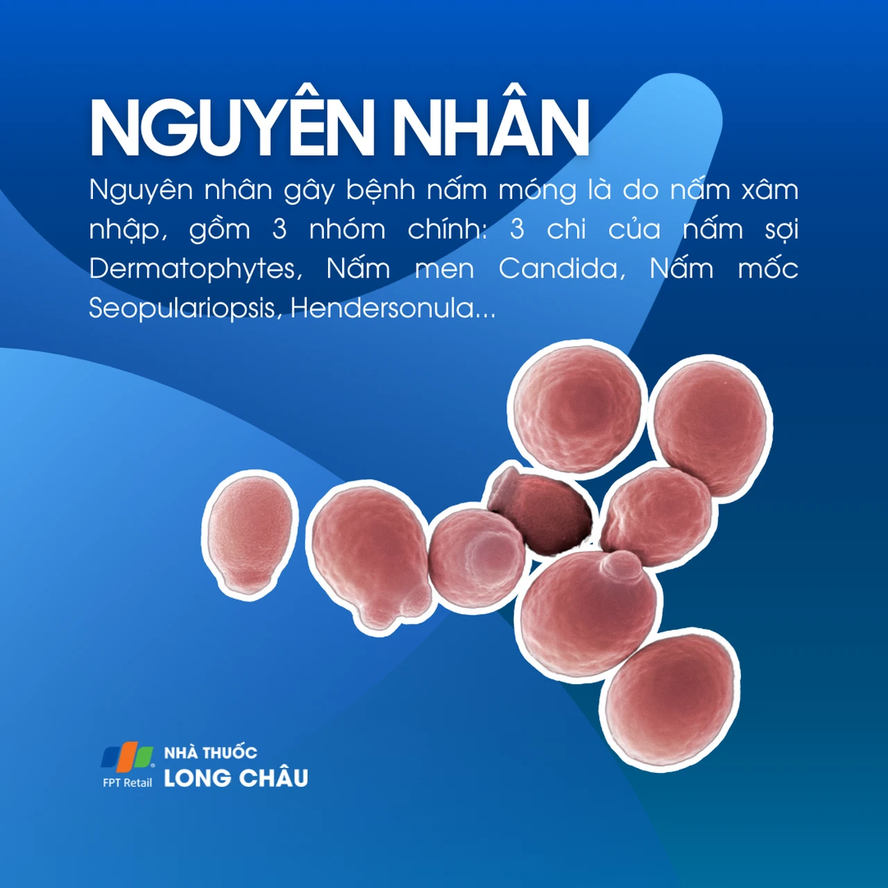 Hình ảnh minh họa