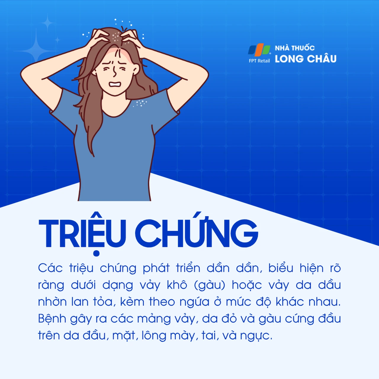 Hình ảnh minh họa