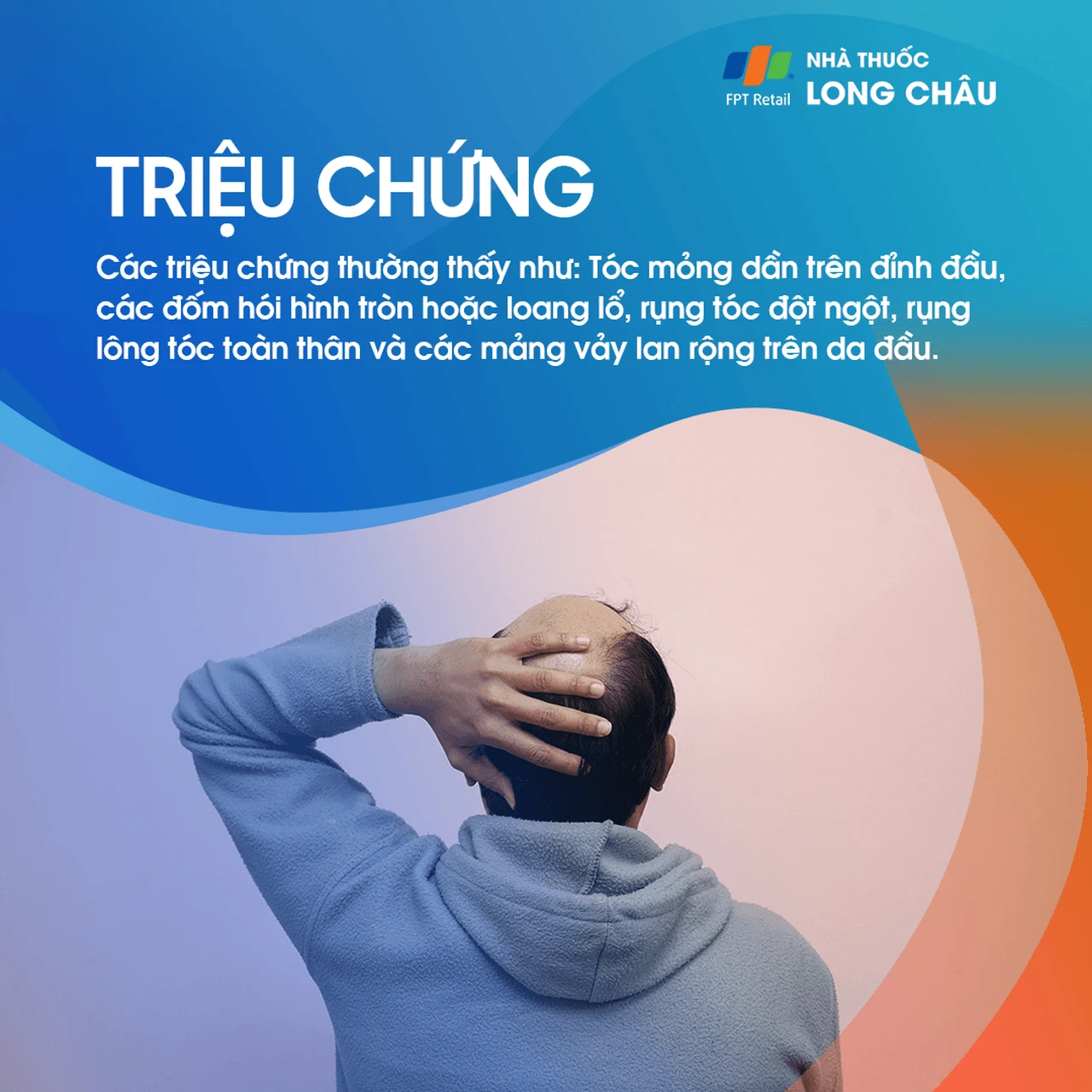 Hình ảnh minh họa