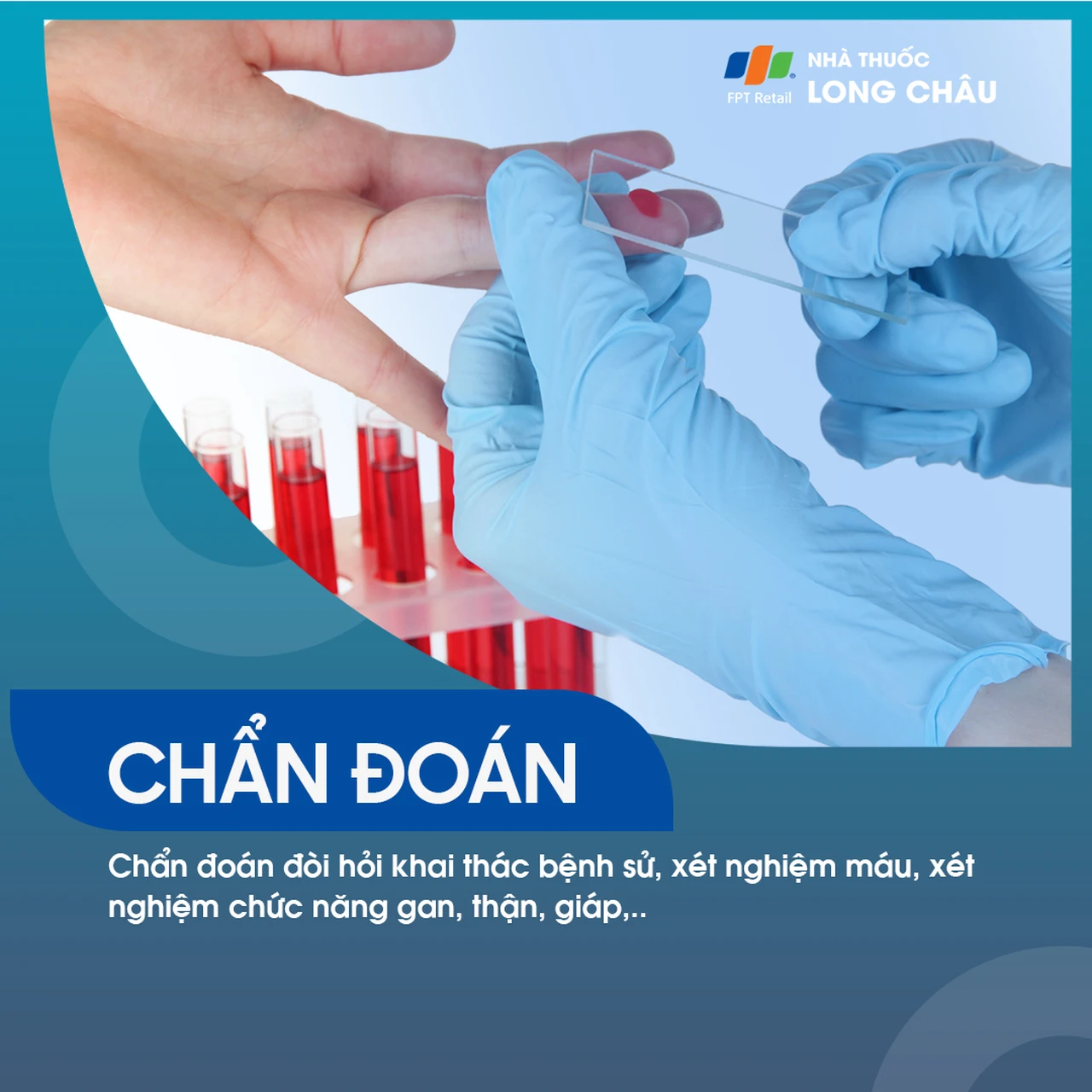 Hình ảnh minh họa