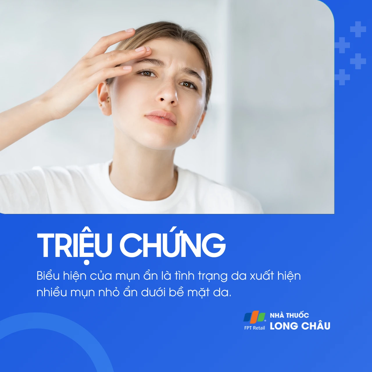 Hình ảnh minh họa