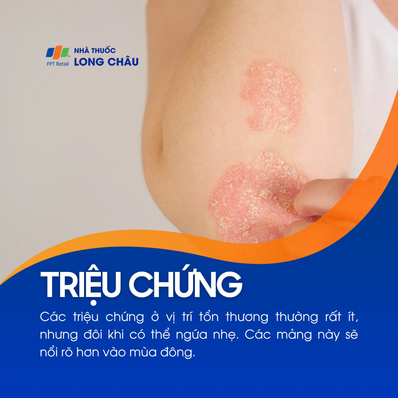 Hình ảnh minh họa