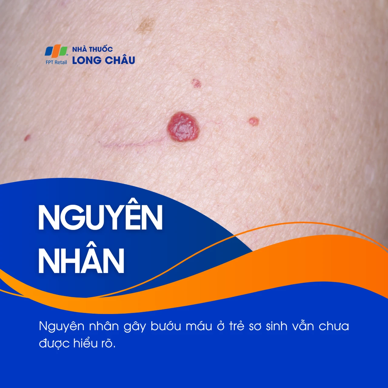 Hình ảnh minh họa