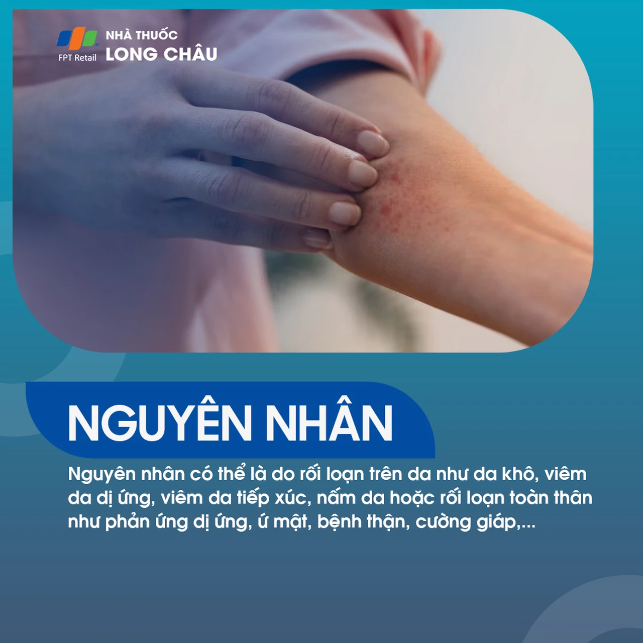 Hình ảnh minh họa