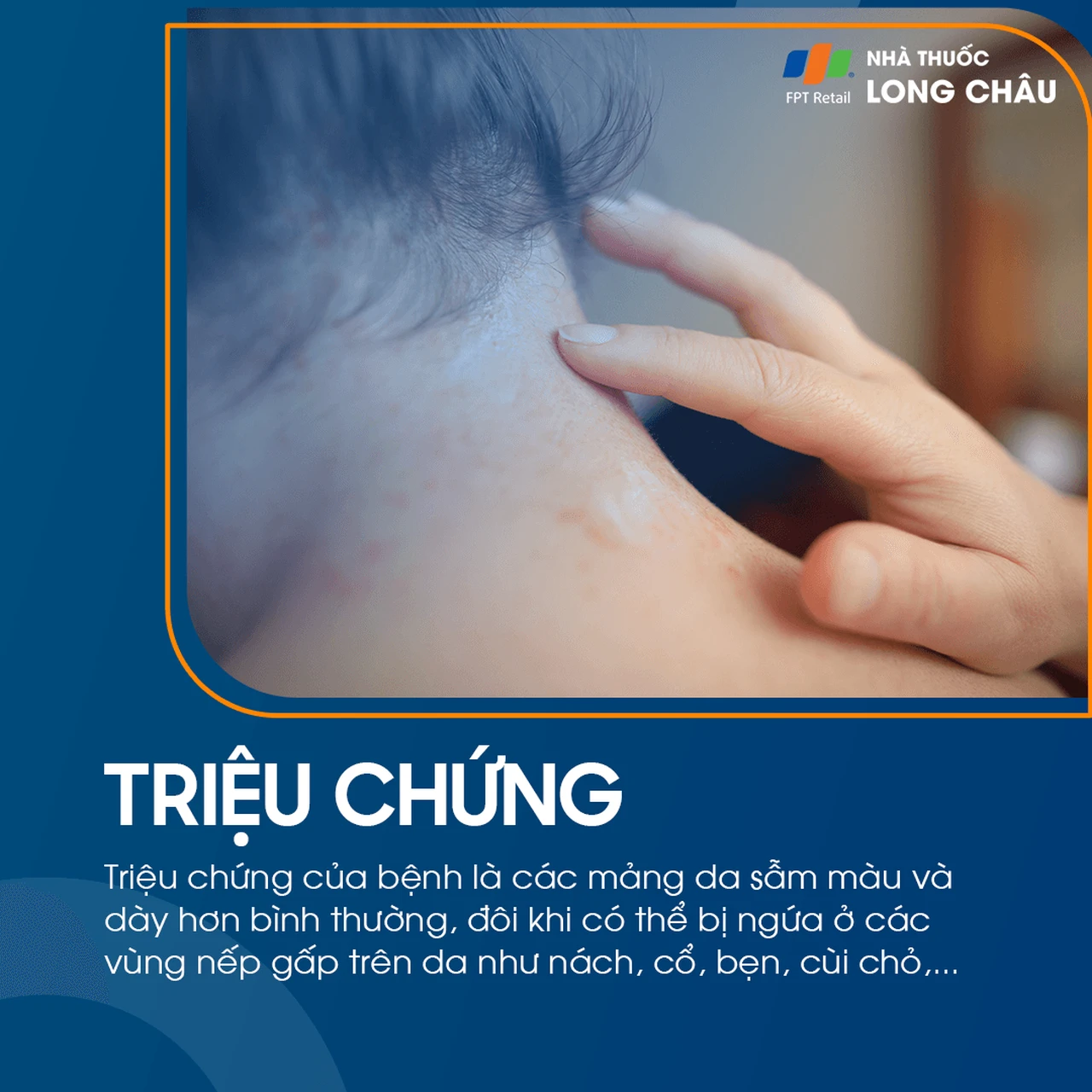 Hình ảnh minh họa
