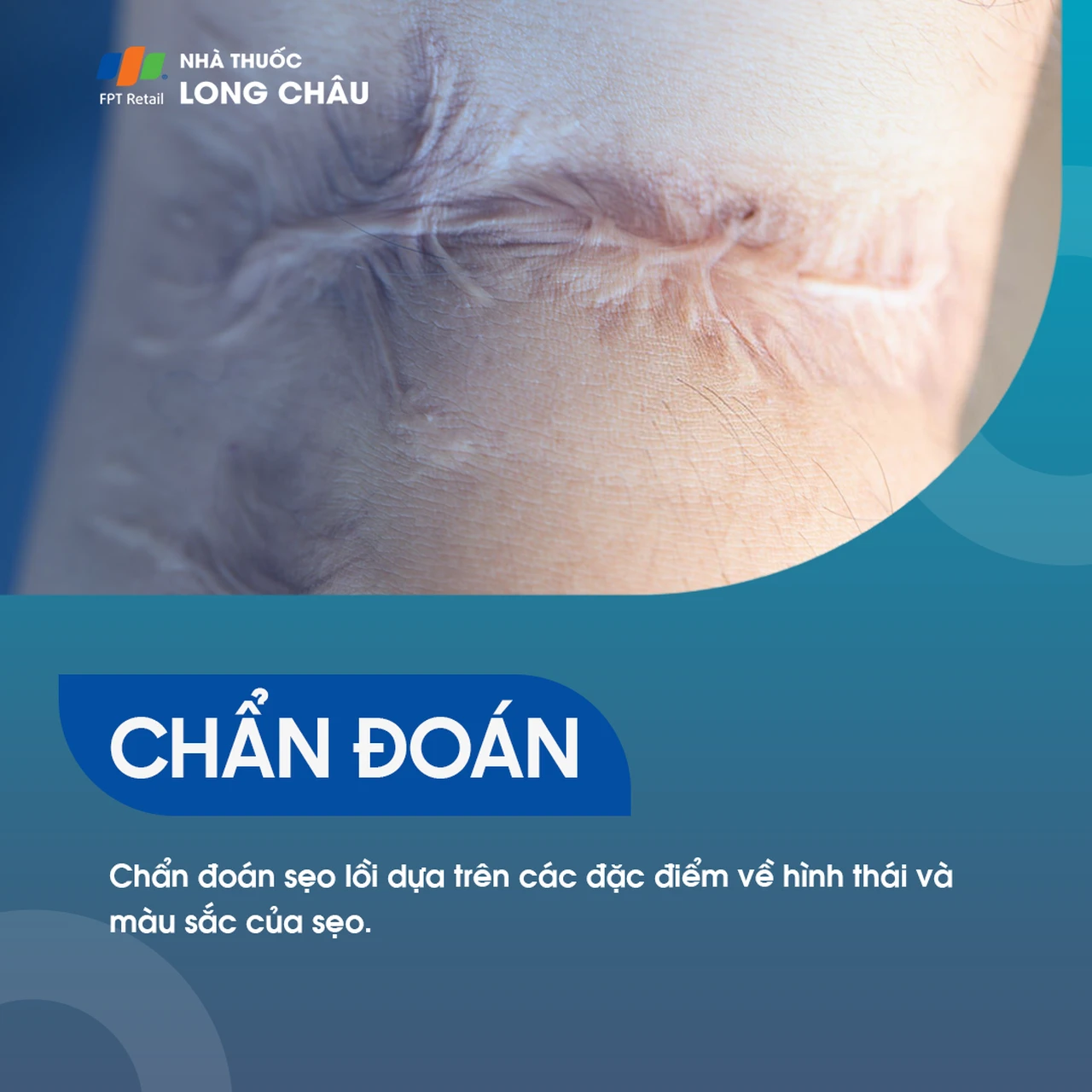 Hình ảnh minh họa