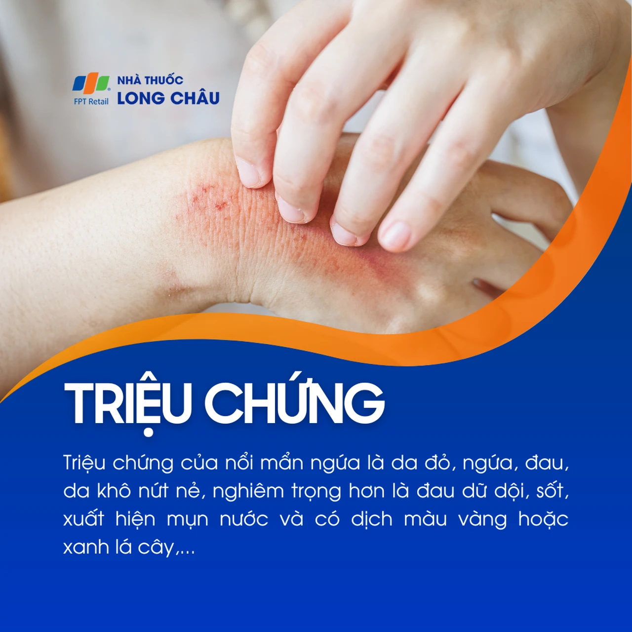 Hình ảnh minh họa