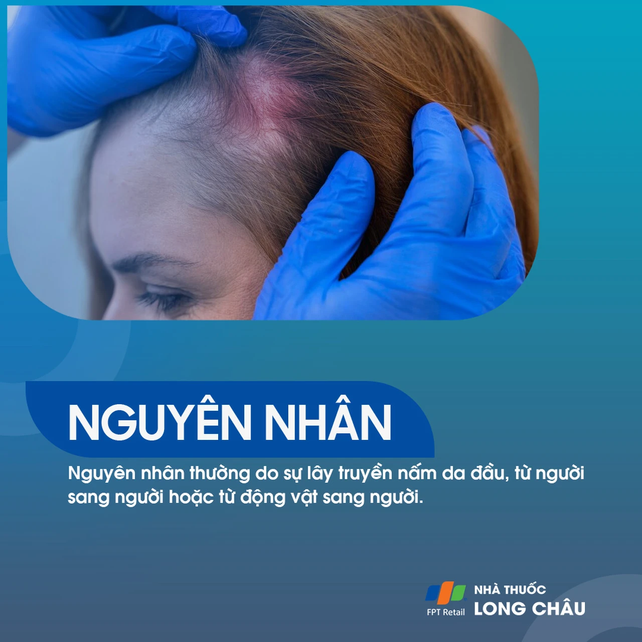 Hình ảnh minh họa