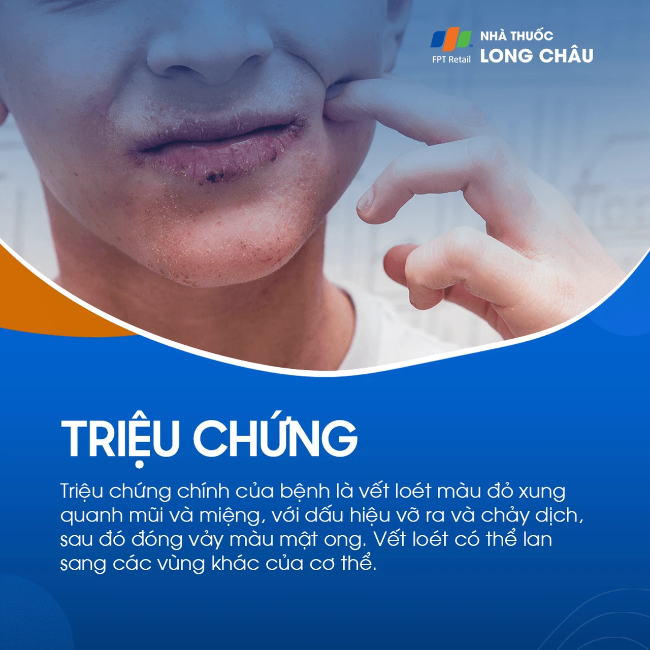 Hình ảnh minh họa