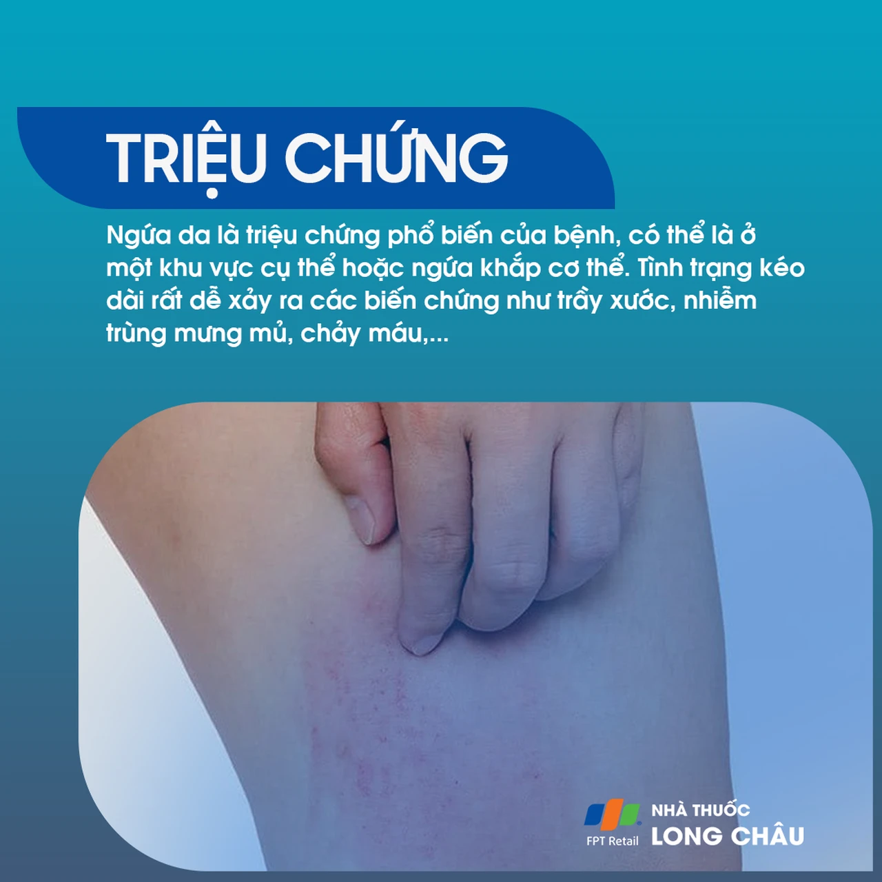 Hình ảnh minh họa