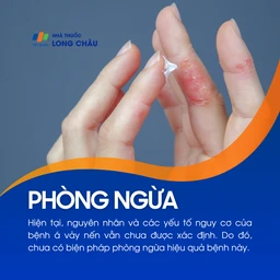 Hình ảnh minh họa