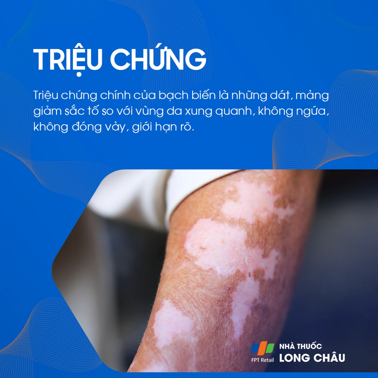 Hình ảnh minh họa