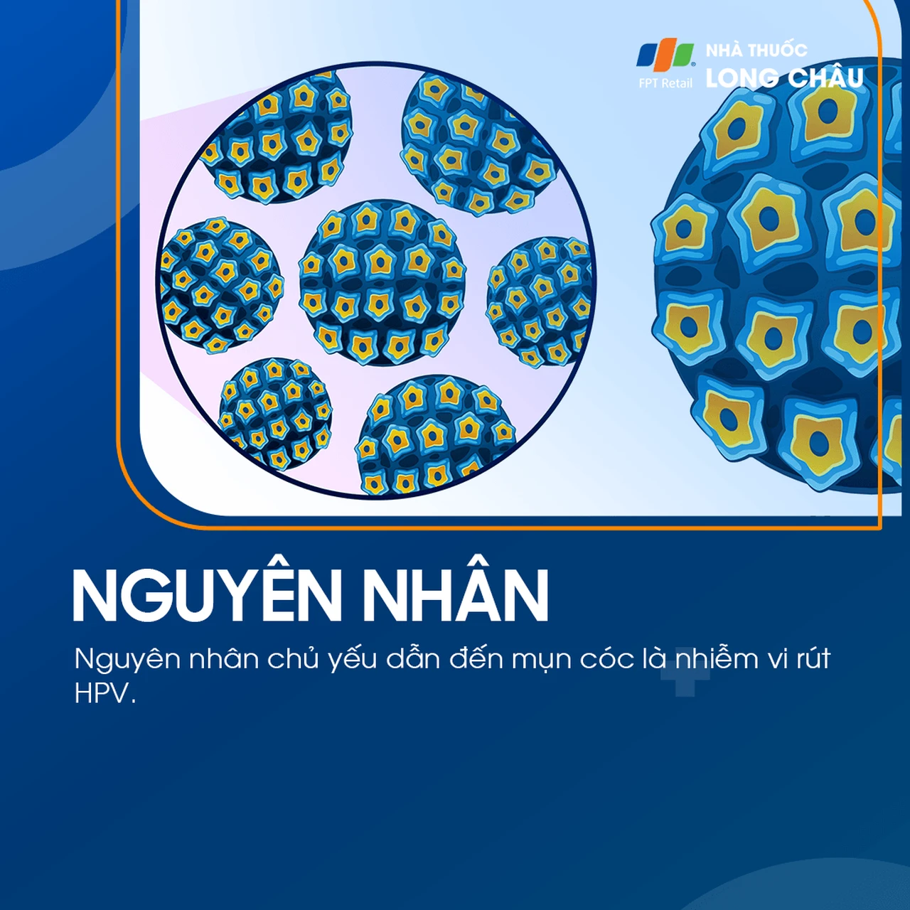Hình ảnh minh họa