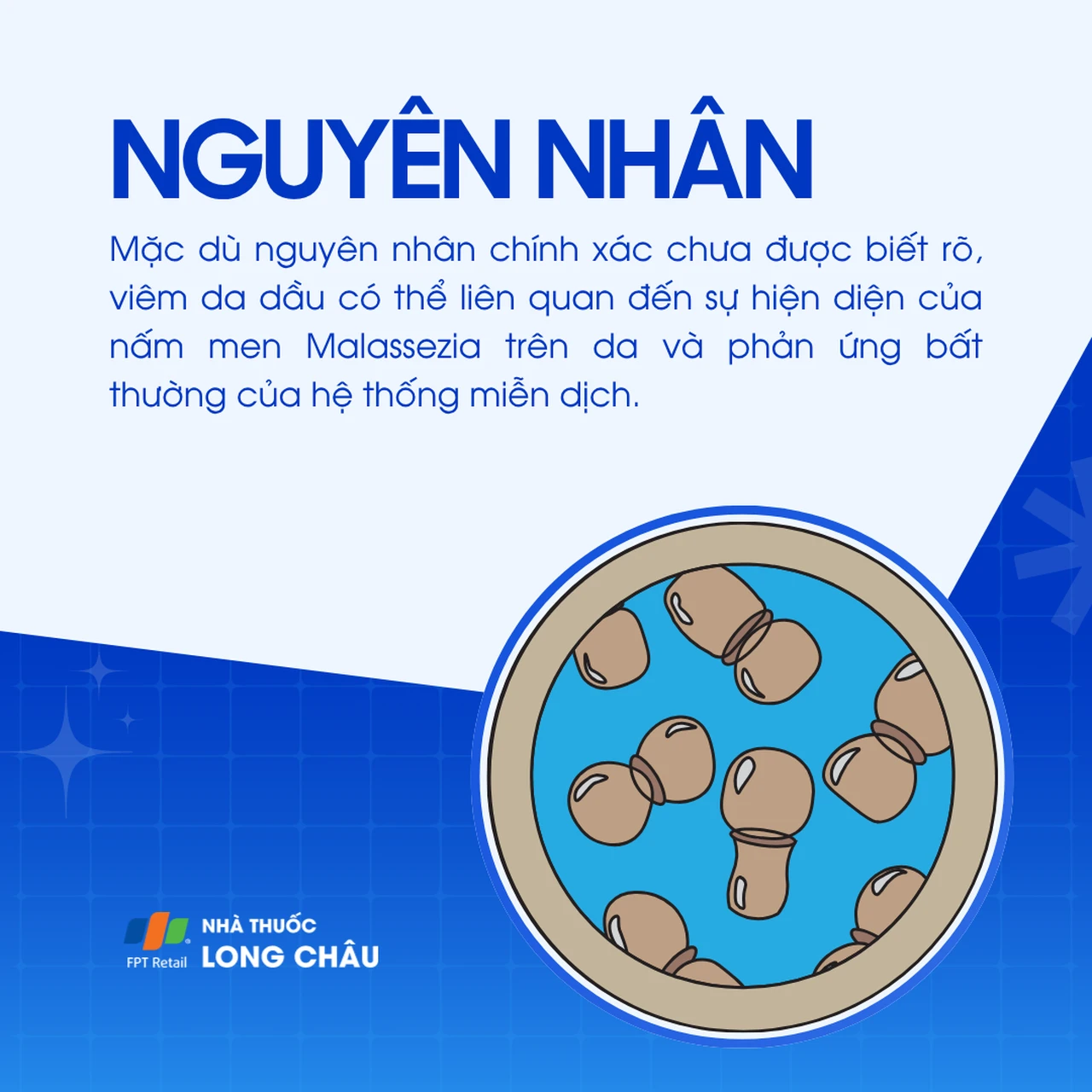 Hình ảnh minh họa
