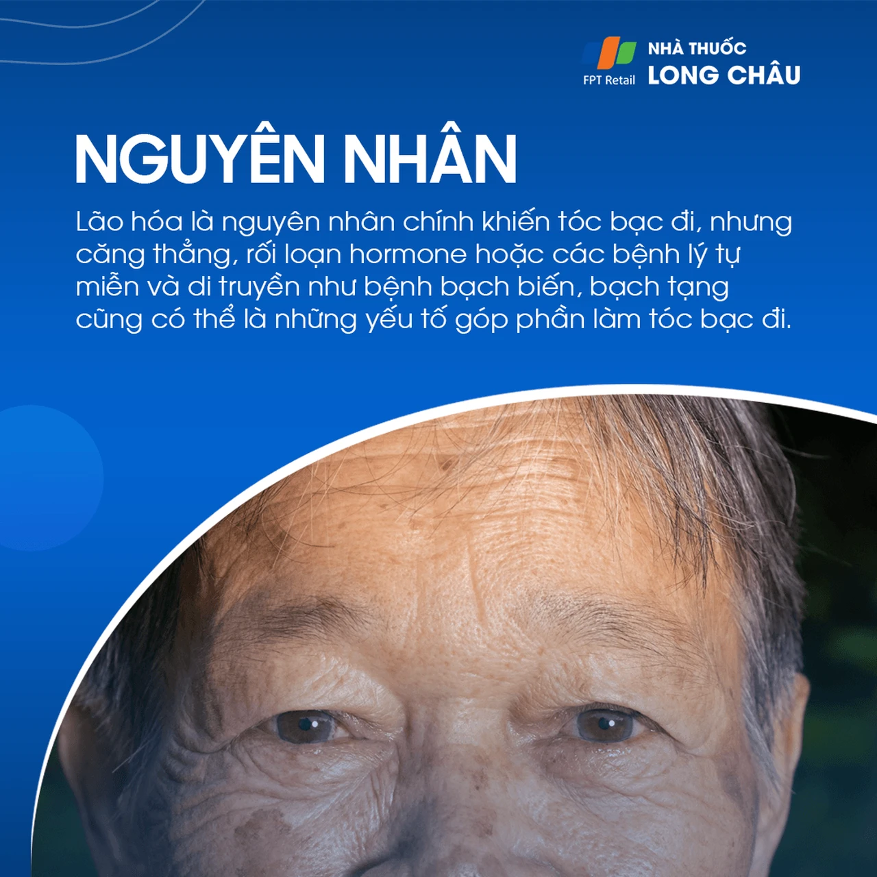 Hình ảnh minh họa