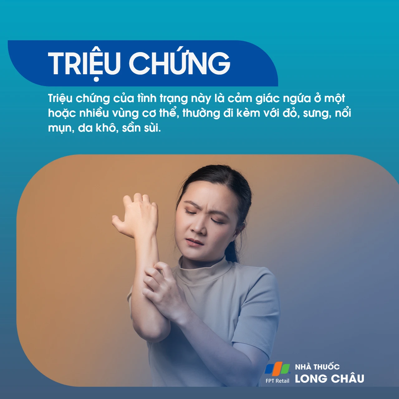 Hình ảnh minh họa