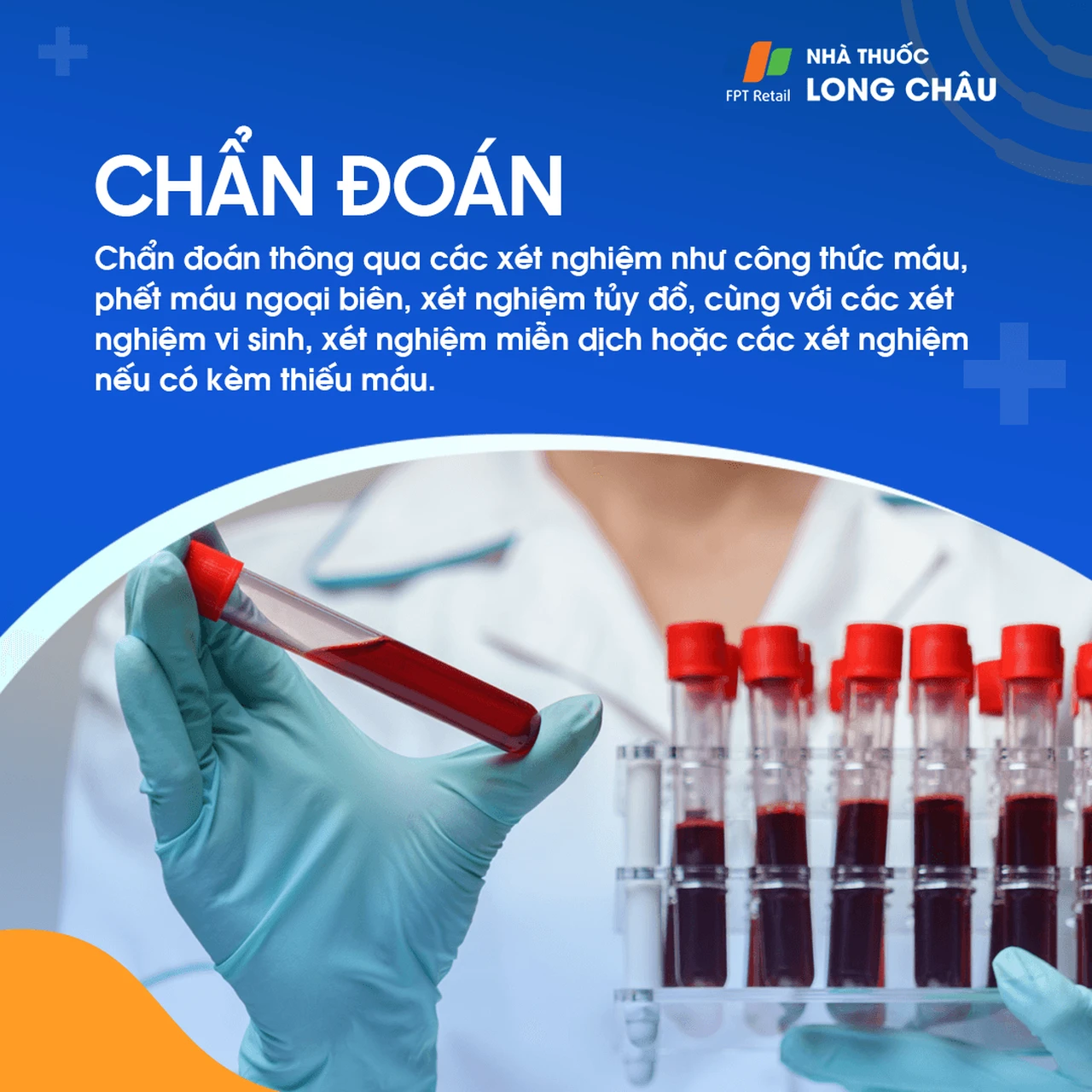Hình ảnh minh họa